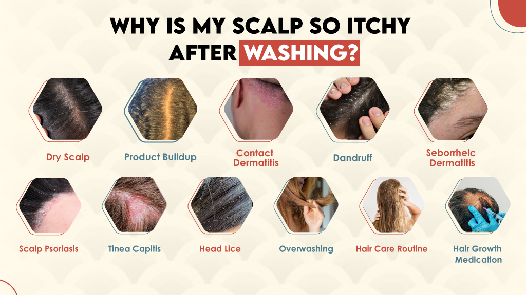 Why is My Scalp So Itchy After Washing? 