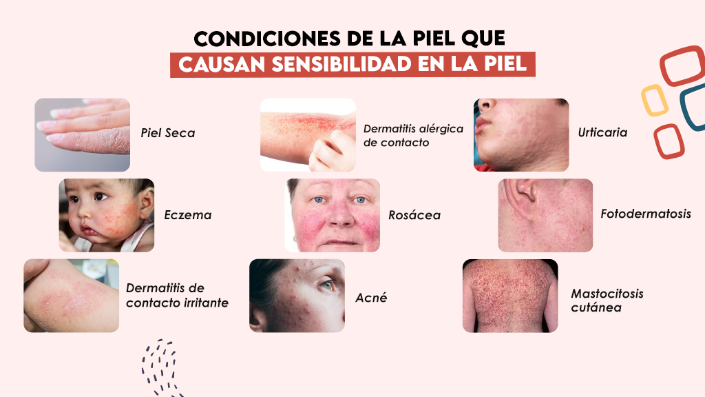 Condiciones de la piel que causan sensibilidad en la piel