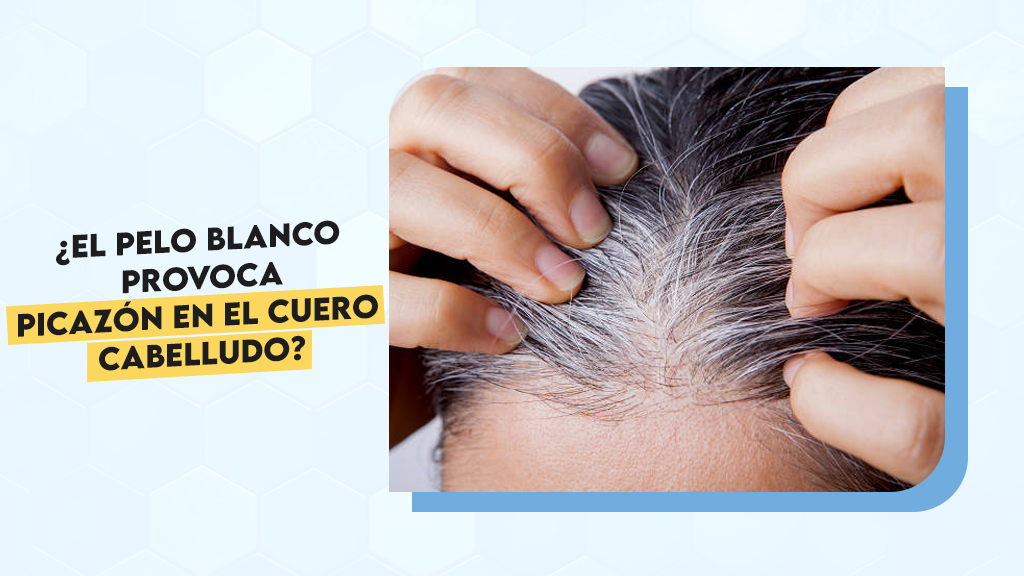 ¿El pelo blanco provoca picazón en el cuero cabelludo?