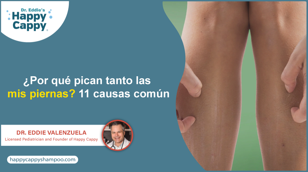 ¿Por qué pican tanto las mis piernas? 11 causas común