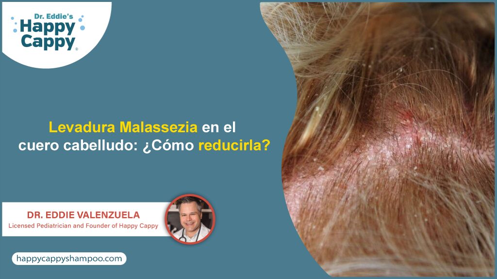 Levadura Malassezia en el cuero cabelludo: ¿Cómo reducirla?