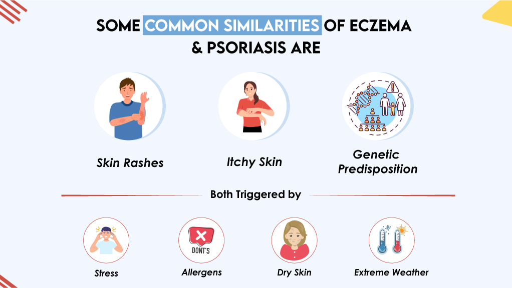 Some Common Similarities of Eczema & Psoriasis are