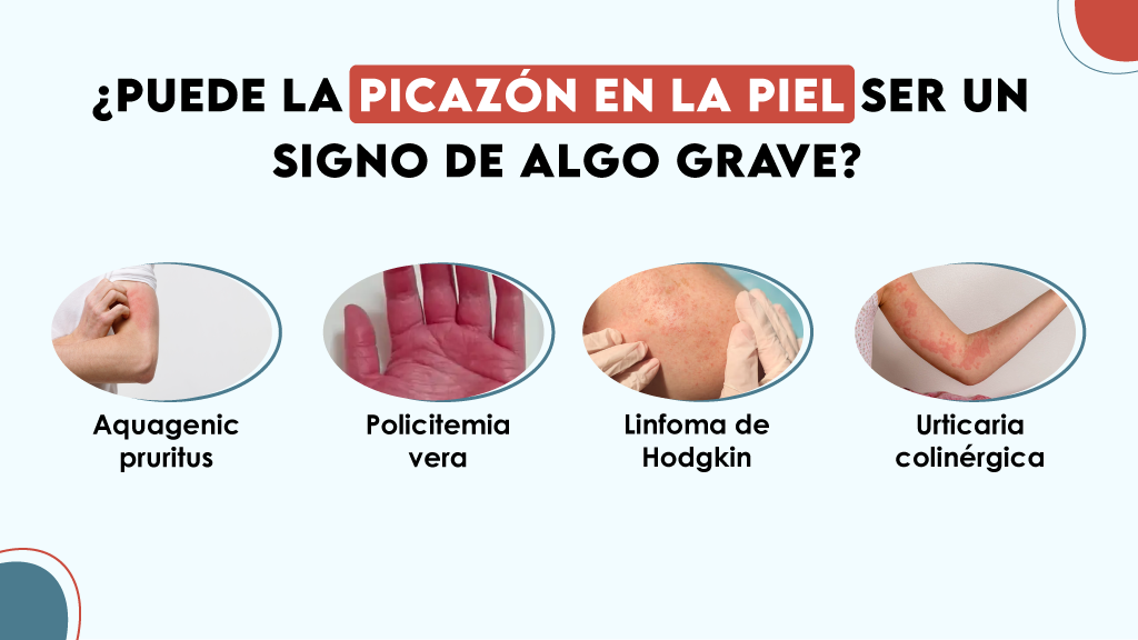 ¿Puede la picazón en la piel ser un signo de algo grave?