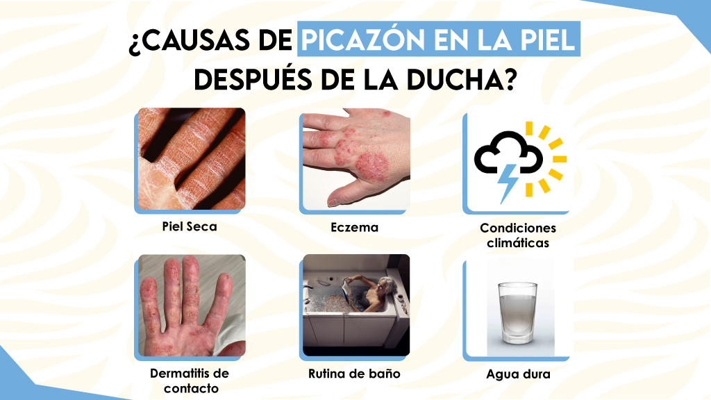 ¿Causas de picazón en la piel después de la ducha?