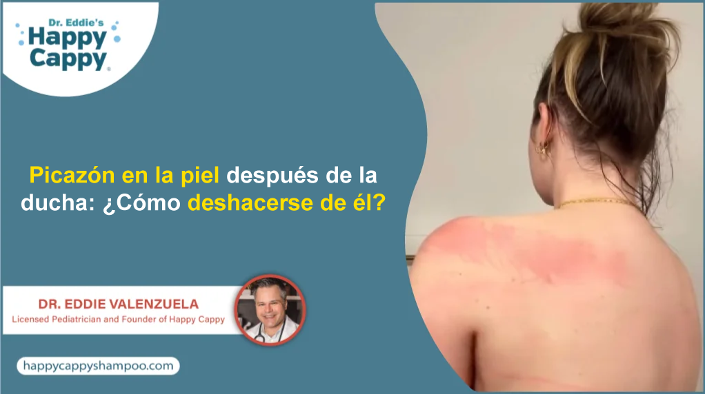 Picazón en la piel después de la ducha: ¿Cómo deshacerse de él?