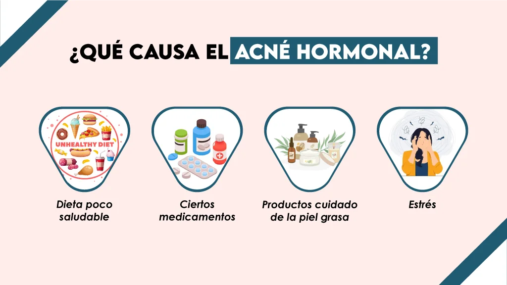 ¿Qué causa el acné hormonal?