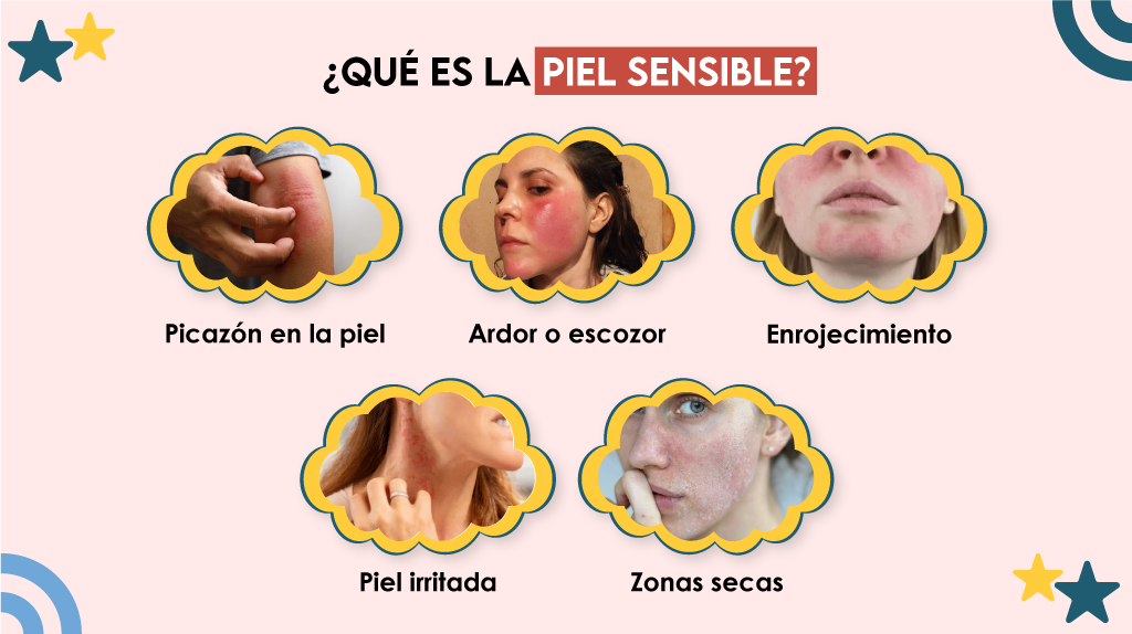 ¿Qué es la piel sensible?