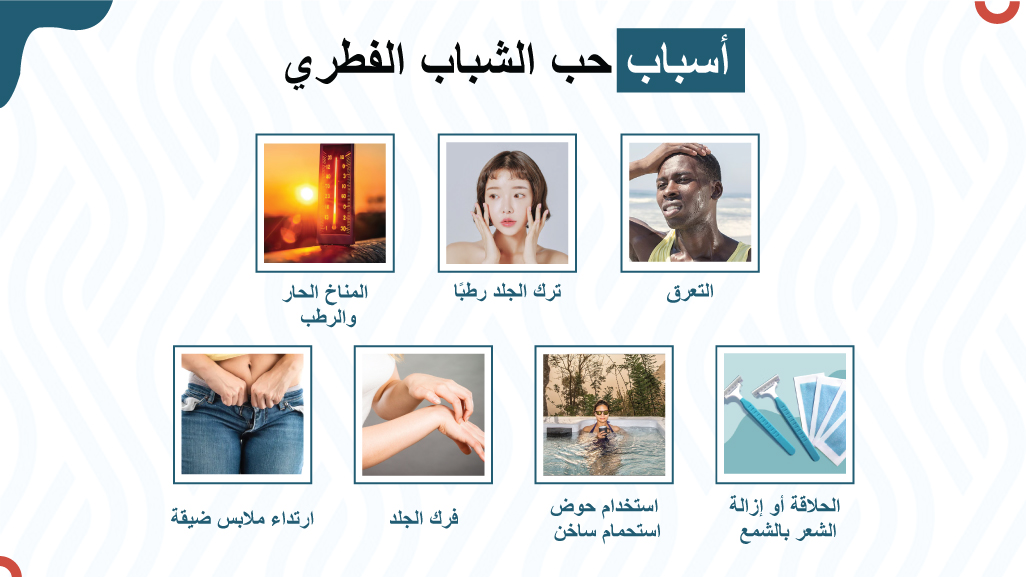أسباب حب الشباب الفطري