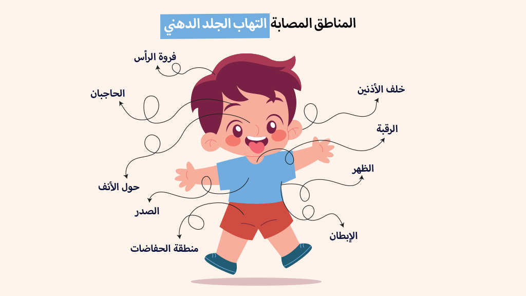 المناطق المصابة التهاب الجلد الدهني