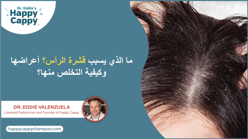 ما الذي يسبب قشرة الرأس؟ أعراضها وكيفية التخلص منها؟