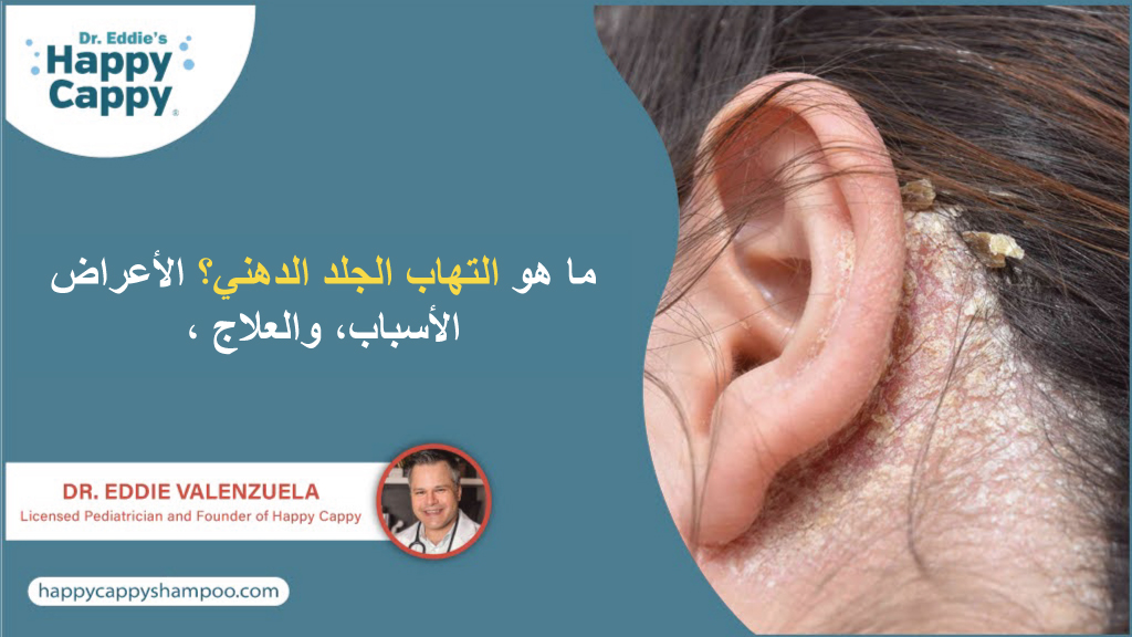 ما هو التهاب الجلد الدهني؟ الأعراض، الأسباب، والعلاج