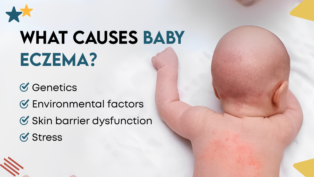 What Causes Baby Eczema?