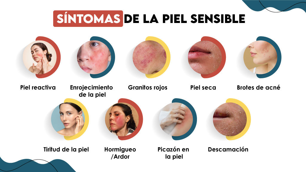 Síntomas de la piel sensible