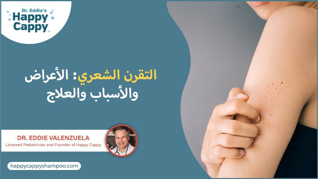 التقرن الشعري: الأعراض والأسباب والعلاج