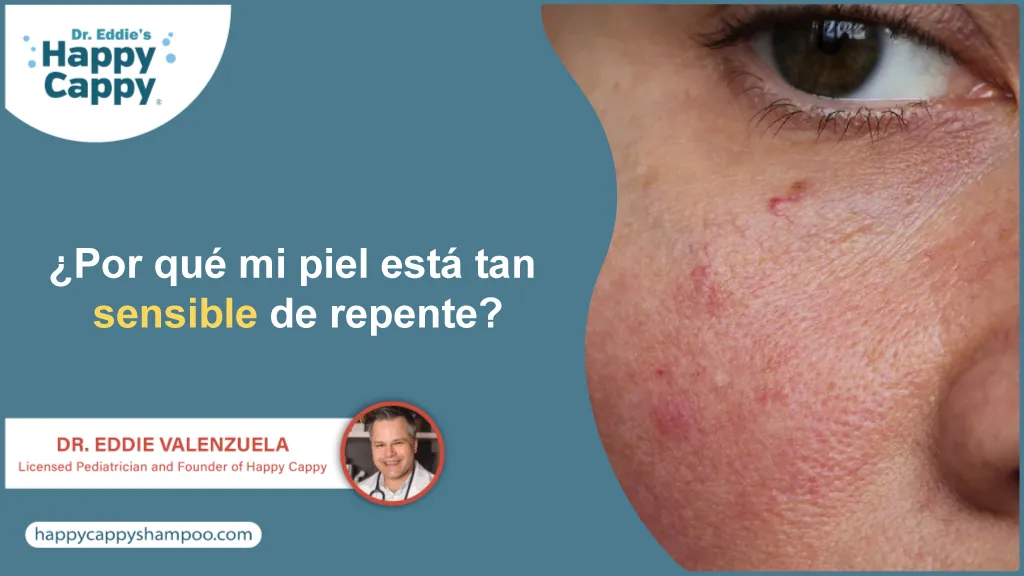 ¿Por qué mi piel está tan sensible de repente?