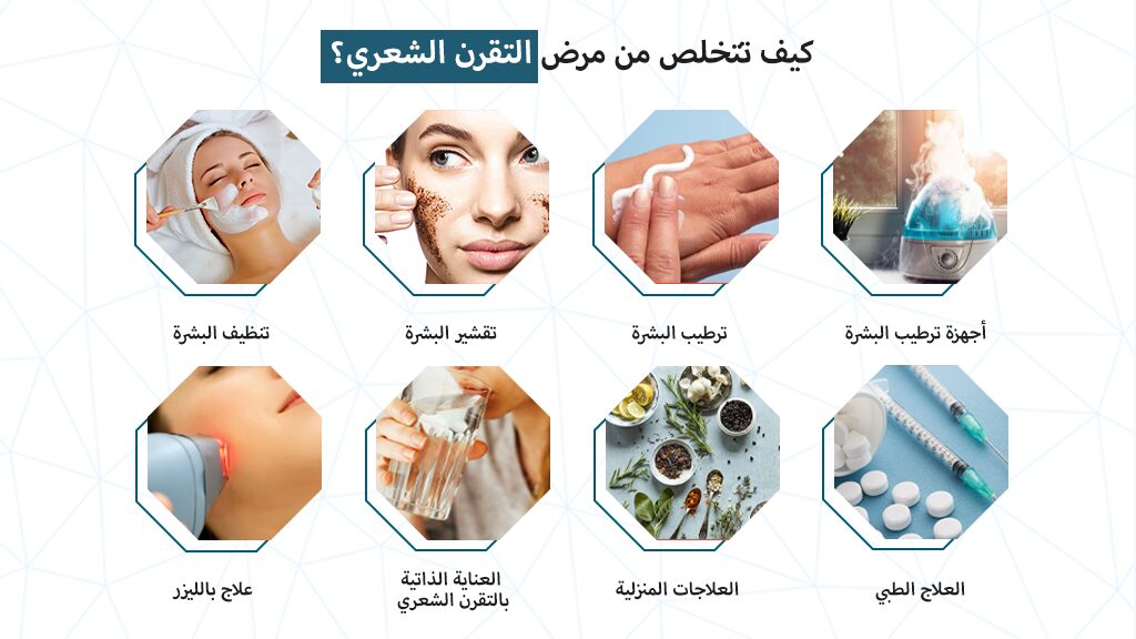 كيف تتخلص من مرض التقرن الشعري؟