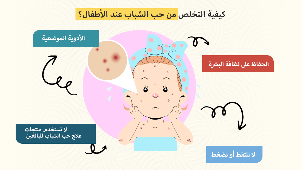 كيفية التخلص من حب الشباب عند الأطفال؟