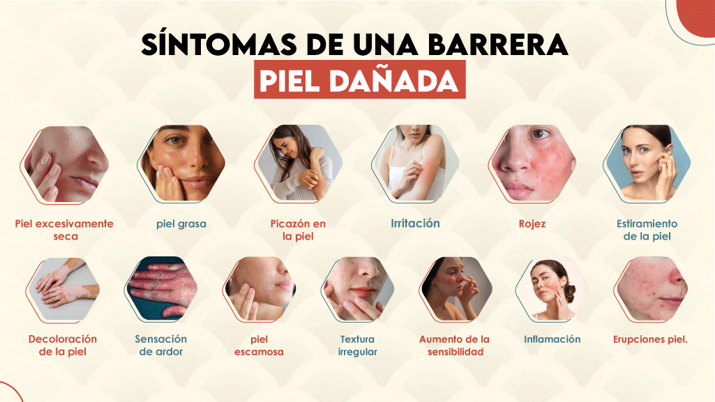 Síntomas de una Barrera Piel Dañada