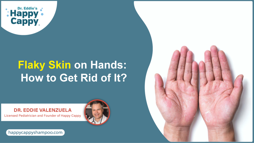 Flaky Skin on Hands: Causes & Treatment Tips | Pediatrician Dr. Eddie Valenzuela Explains
