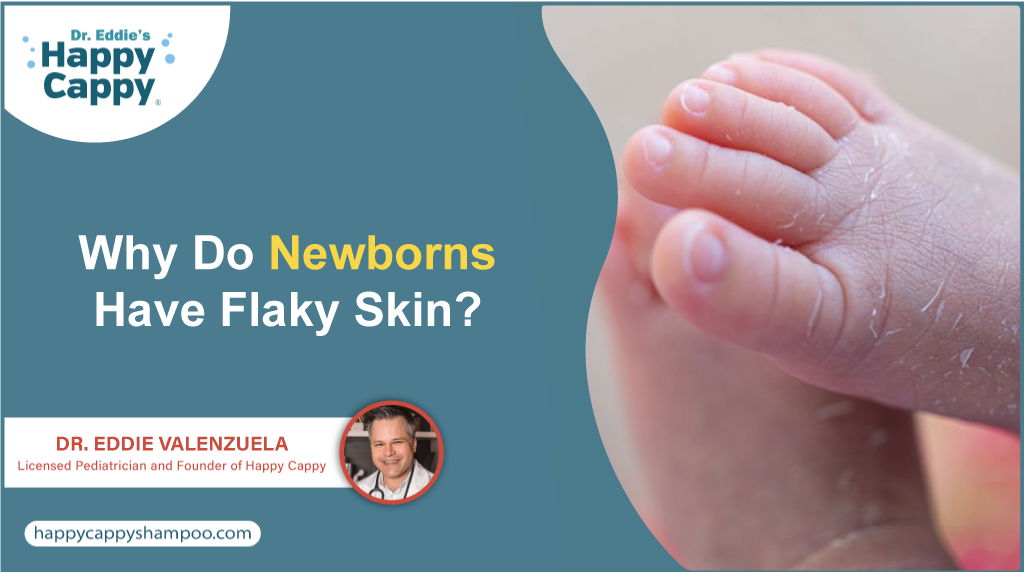 Why Do Newborns Have Flaky Skin? Dr. Eddie Valenzuela Explains Causes & Safe Solutions.
