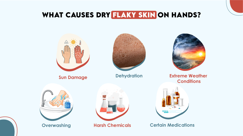 Dry Flaky Skin on Hands: 7 Key Causes (Sun Damage, Dehydration, Harsh Chemicals & More).