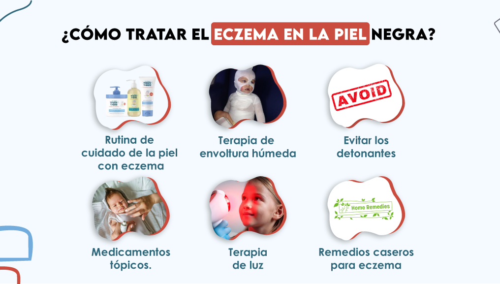 ¿Cómo tratar el eczema en la piel negra?