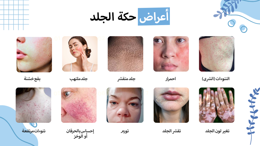 أعراض حكة الجلد