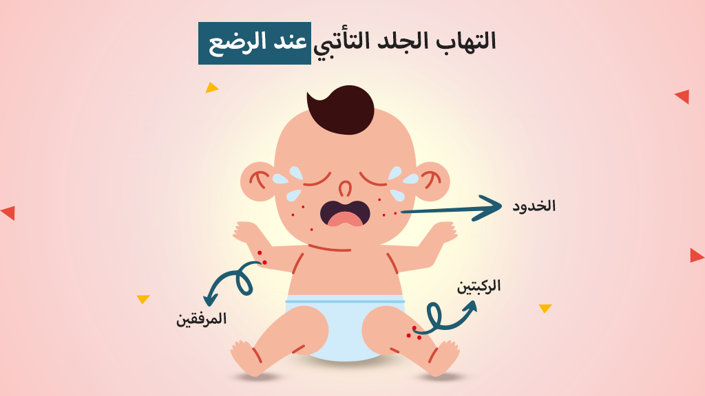 التهاب الجلد التأتبي عند الرضع