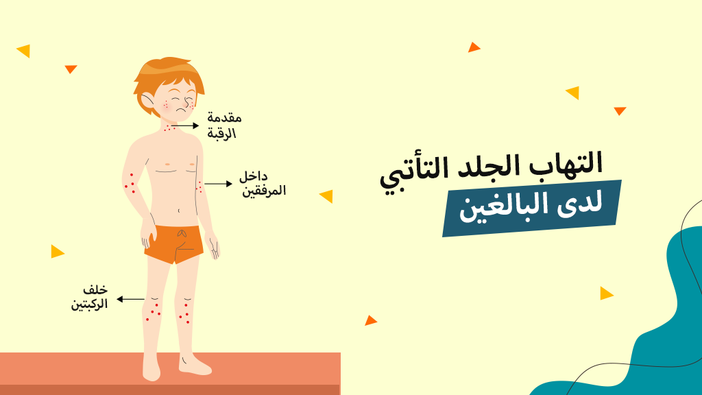 التهاب الجلد التأتبي لدى البالغين