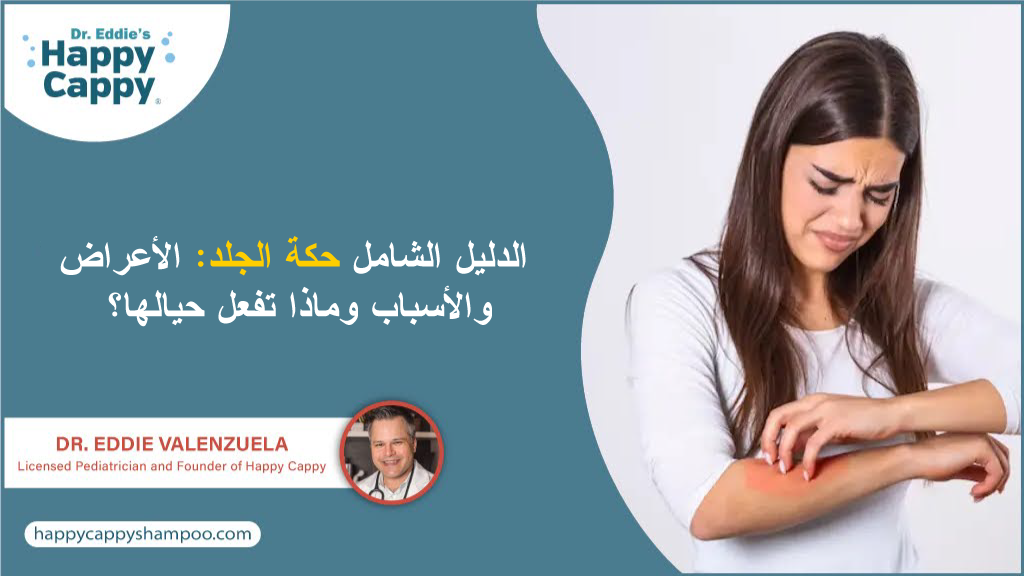 الدليل الشامل حكة الجلد: الأعراض والأسباب وماذا تفعل حيالها؟