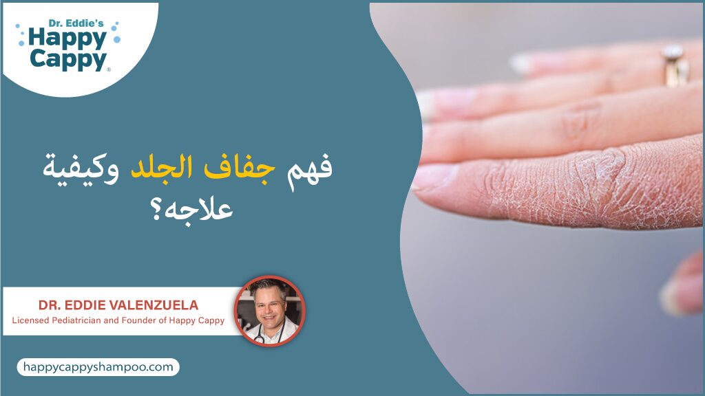 فهم جفاف الجلد وكيفية علاجه؟