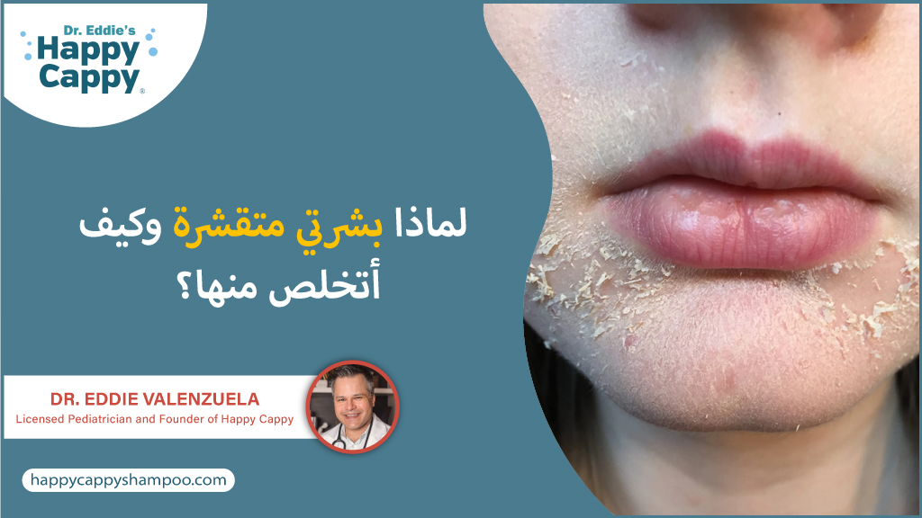 لماذا بشرتي متقشرة وكيف أتخلص منها؟