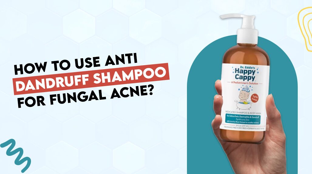 How to Use Anti Dandruff Shampoo for Fungal Acne?