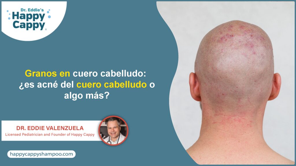 Granos en cuero cabelludo: ¿es acné del cuero cabelludo o algo más?