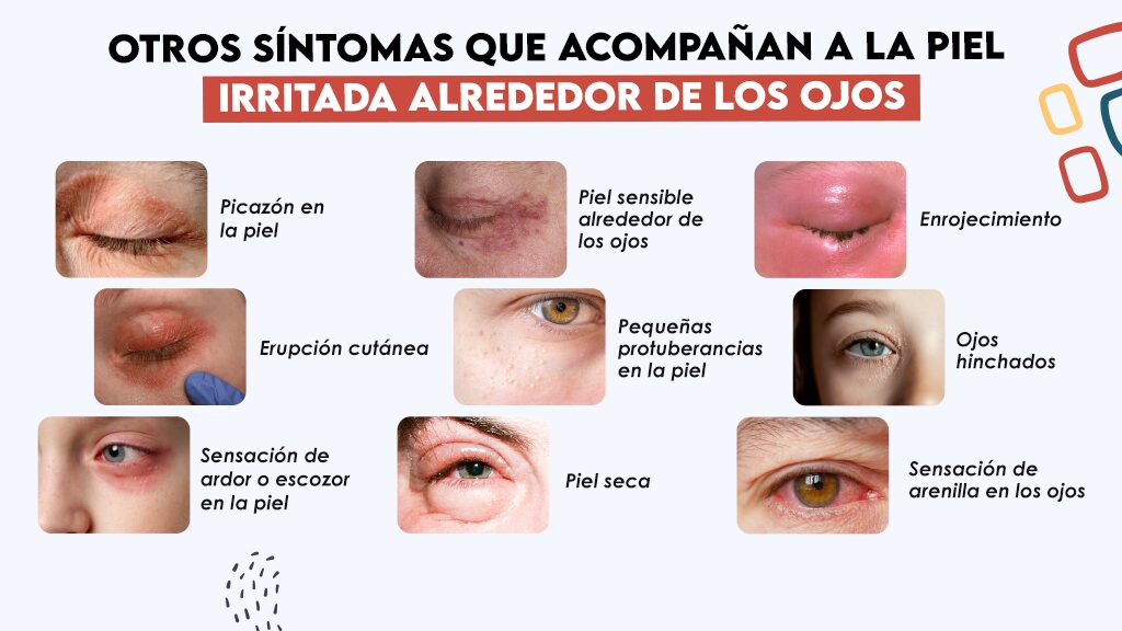 Otros síntomas que acompañan a la piel irritada alrededor de los ojos