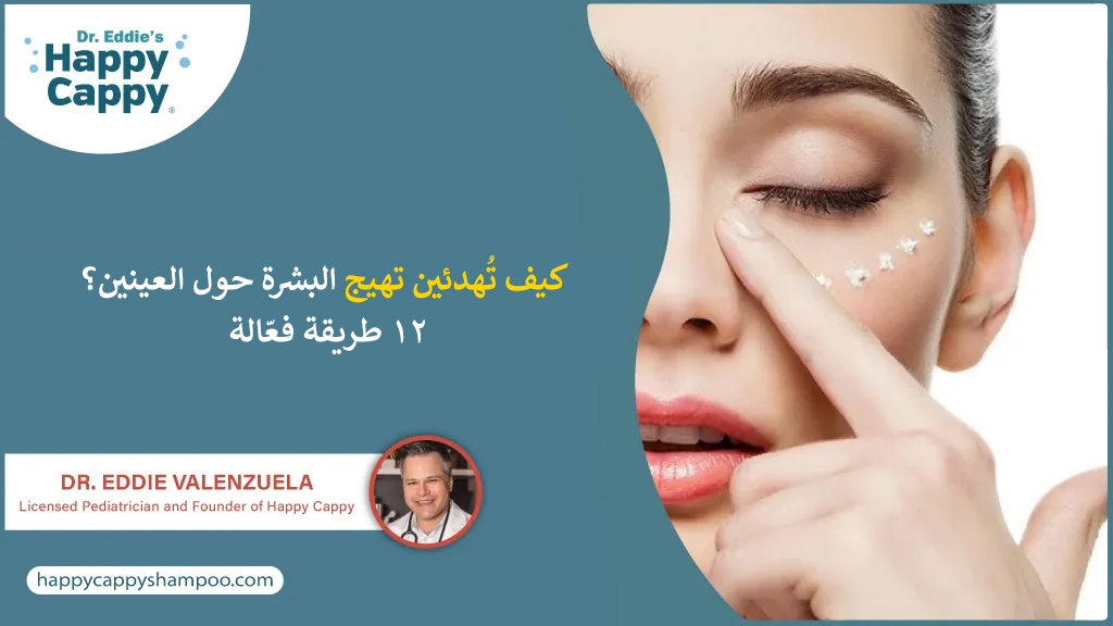 كيف تُهدئين تهيج البشرة حول العينين؟ ١٢ طريقة فعّالة