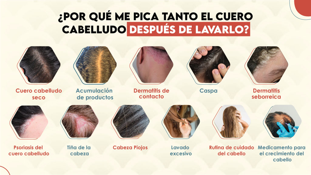 ¿Por qué me pica tanto el cuero cabelludo después de lavarlo?