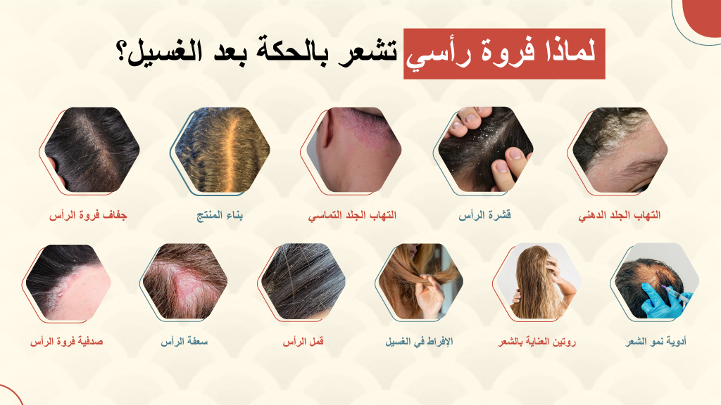 لماذا فروة رأسي تشعر بالحكة بعد الغسيل؟