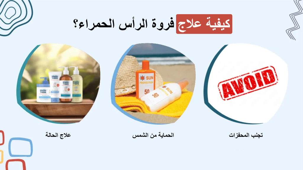 كيفية علاج فروة الرأس الحمراء؟