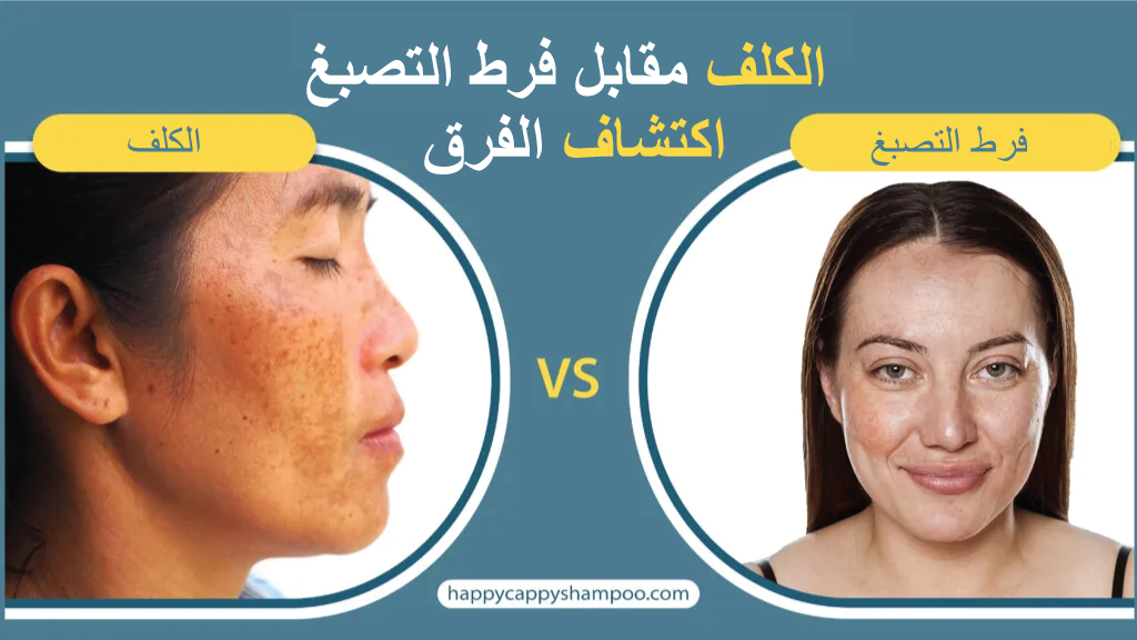 الكلف مقابل فرط التصبغ: اكتشاف الفرق
