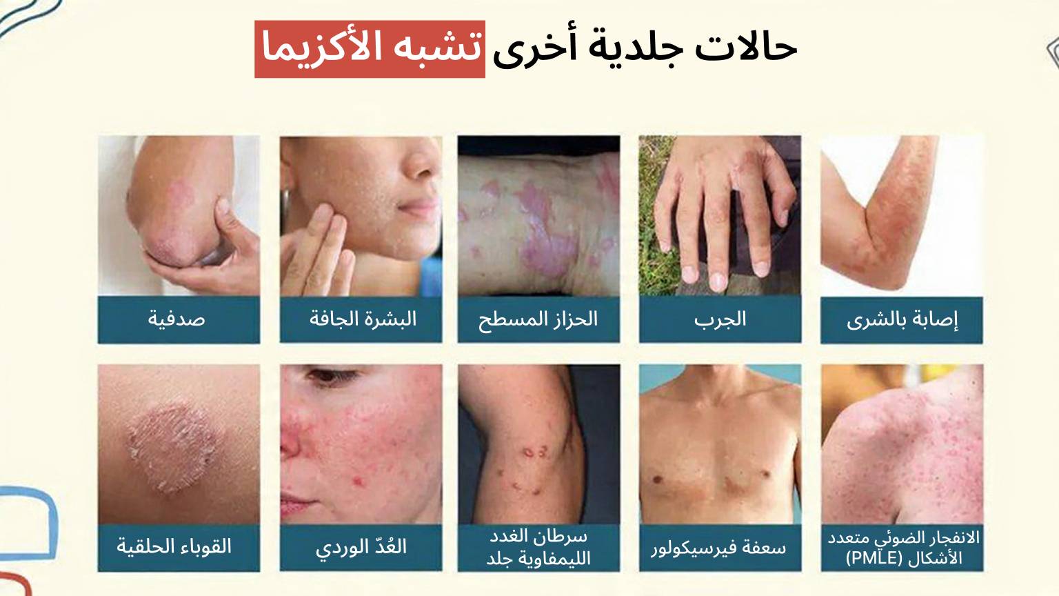 حالات جلدية أخرى تشبه الأكزيما