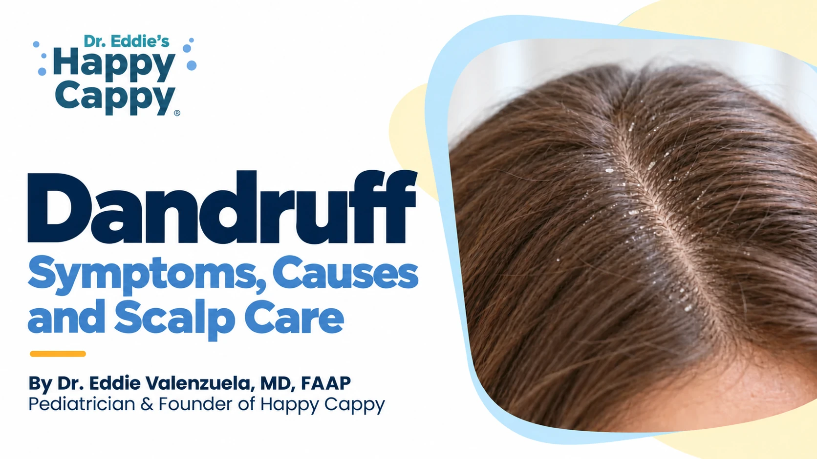 Illustrated scalp flakes beside the title Dandruff: Symptoms, Causes and Scalp Care.