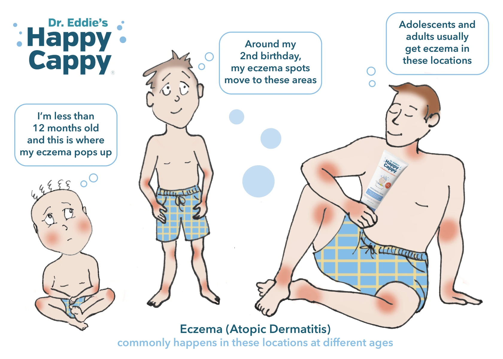 Illustration showing how common eczema locations change from infancy to childhood and adulthood.