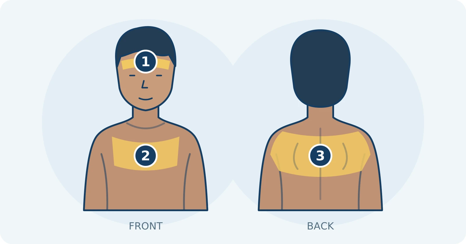 Simplified front and back views highlighting the forehead and hairline, upper chest, and upper back and shoulders.