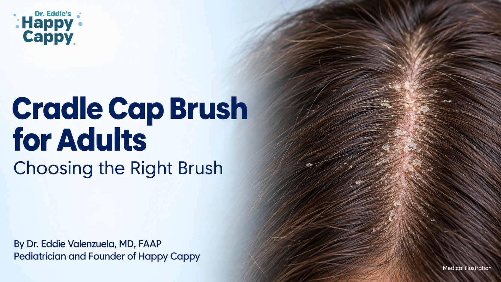 Cradle Cap Brush for Adults: Choosing the Right Brush
