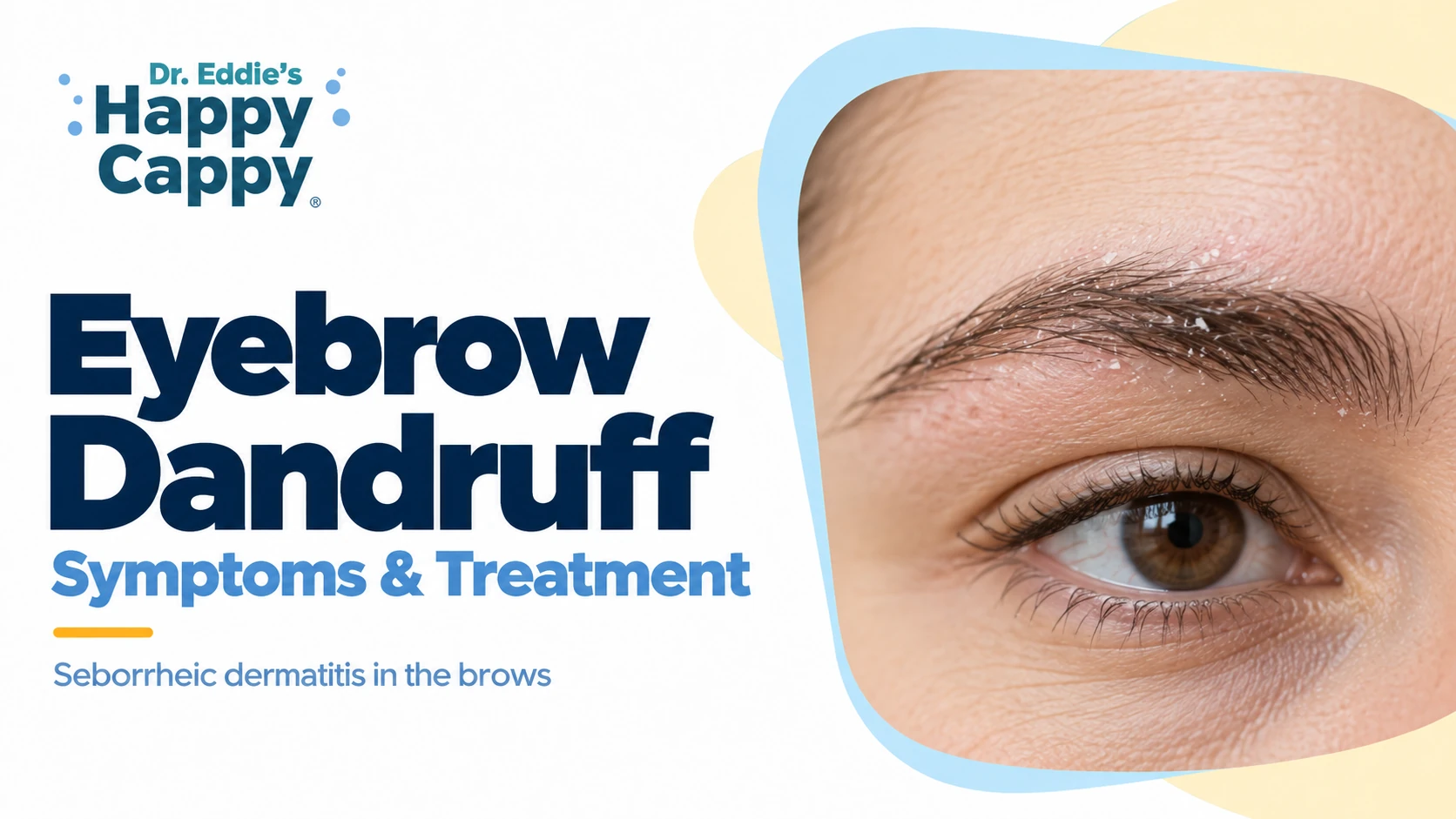 Eyebrow Dandruff and Flaking: Causes and Treatment
