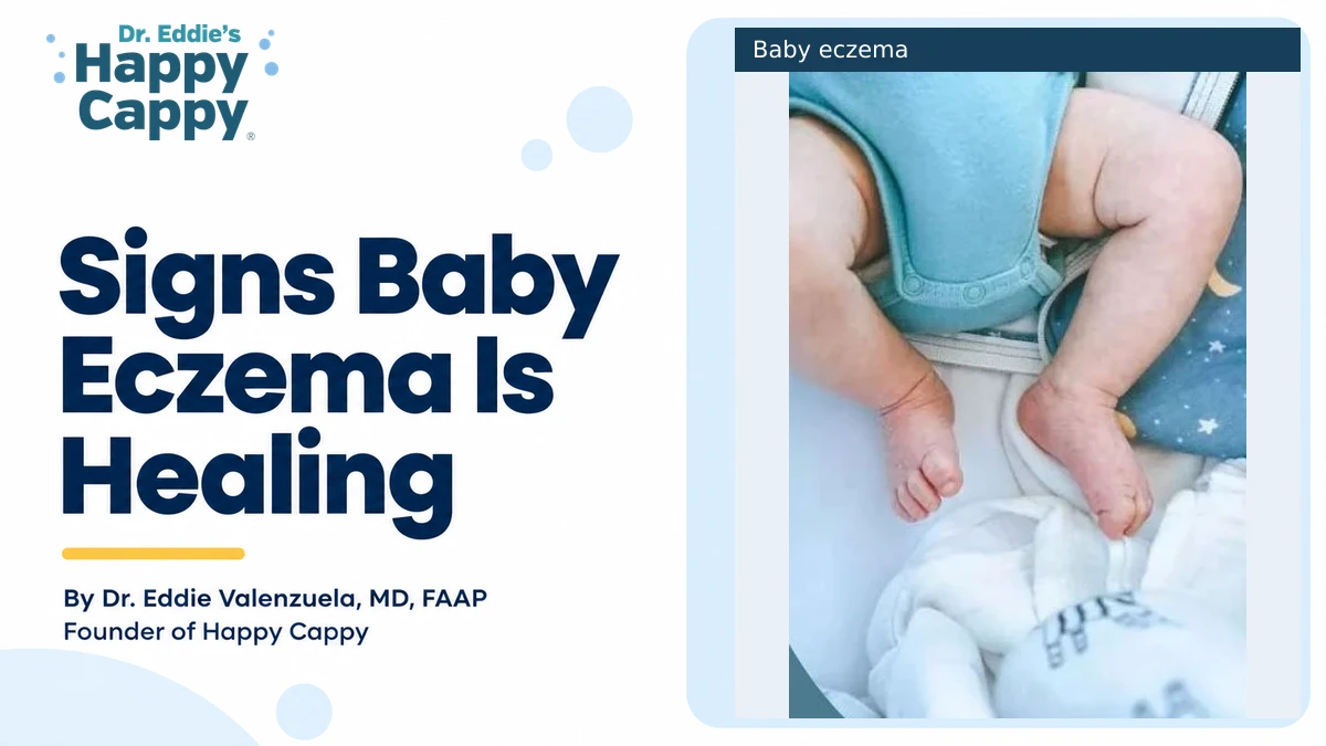 Signs Baby Eczema Is Healing