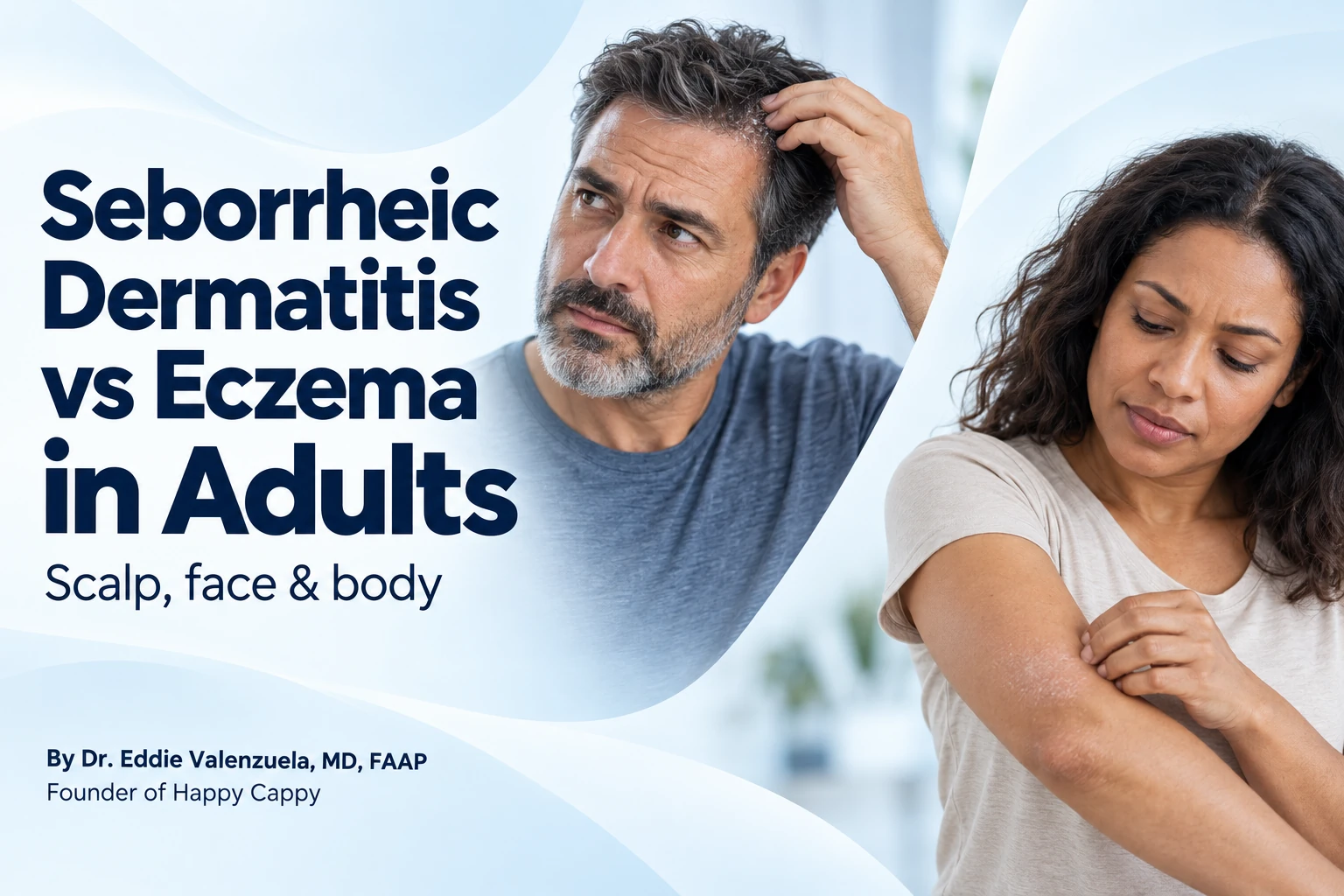 Seborrheic Dermatitis vs Eczema in Adults