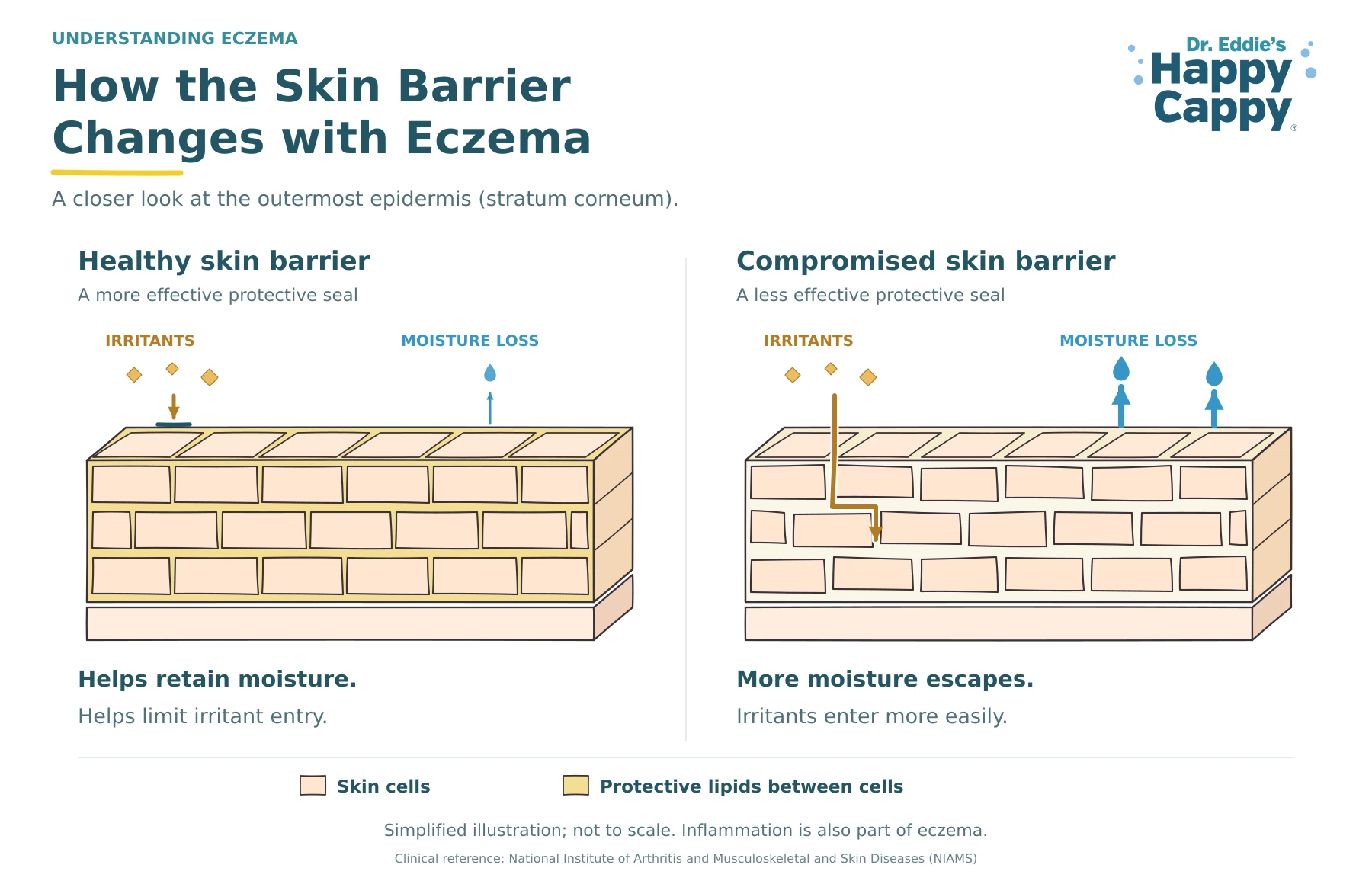 Healthy and compromised skin barriers, showing greater moisture loss and easier irritant entry through the compromised barrier.