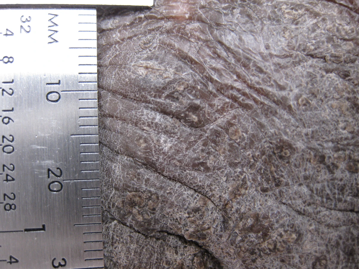 Close-up clinical photograph of lichen simplex chronicus showing pronounced crisscross skin lines, surface scale, and thickening.